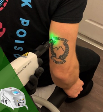 QS laser equipment 2 Sprzęt laserowy QS 2