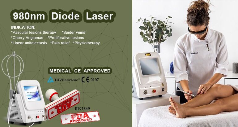 980nm diode laser vascular removal device Urządzenie do usuwania naczyń za pomocą lasera diodowego o długości fali 980 nm