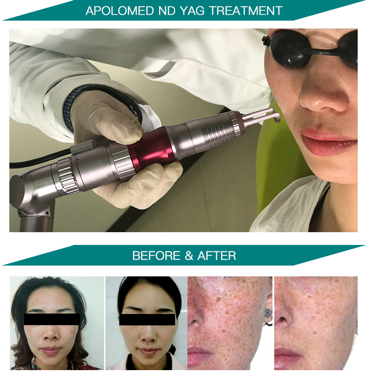 HS-298 przed zdjęciem po