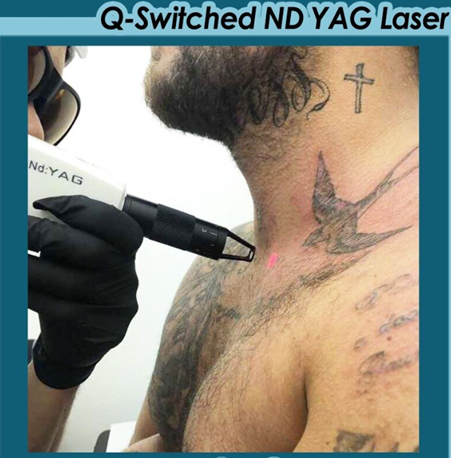 Sprzęt laserowy qs 1