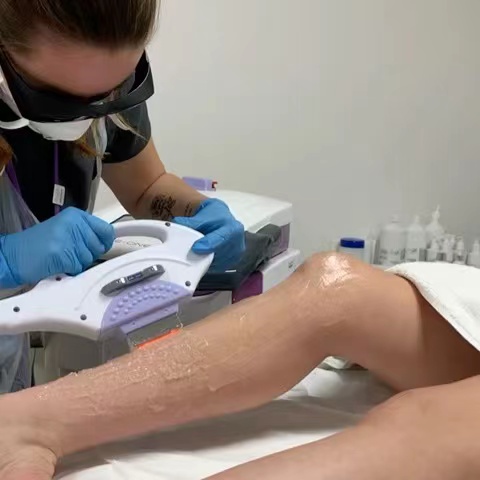 Ile kosztuje laserowe usuwanie włosów