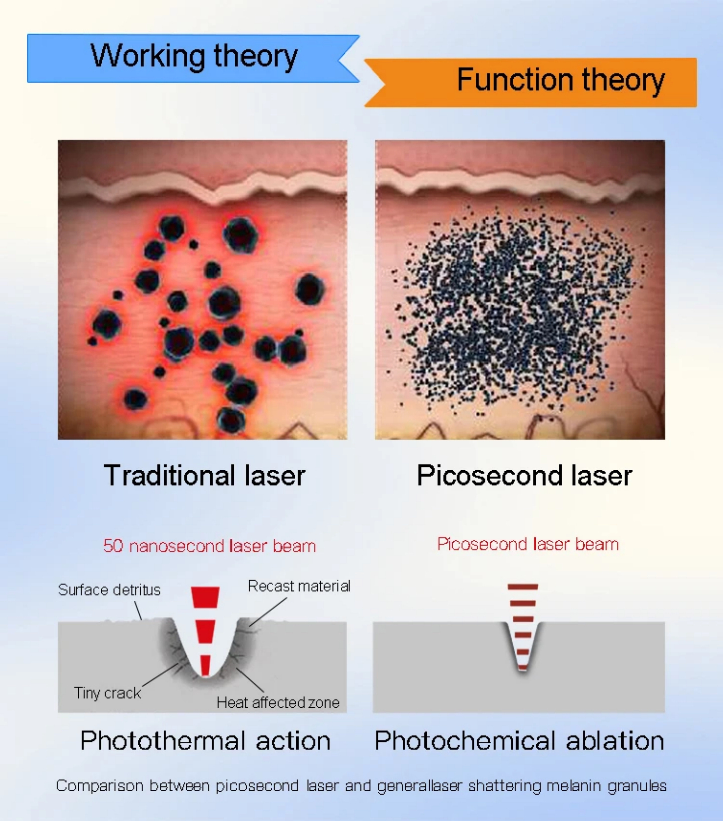 Jaka jest nauka za usuwaniem tatuażu laserowego?